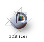 3D Slicer